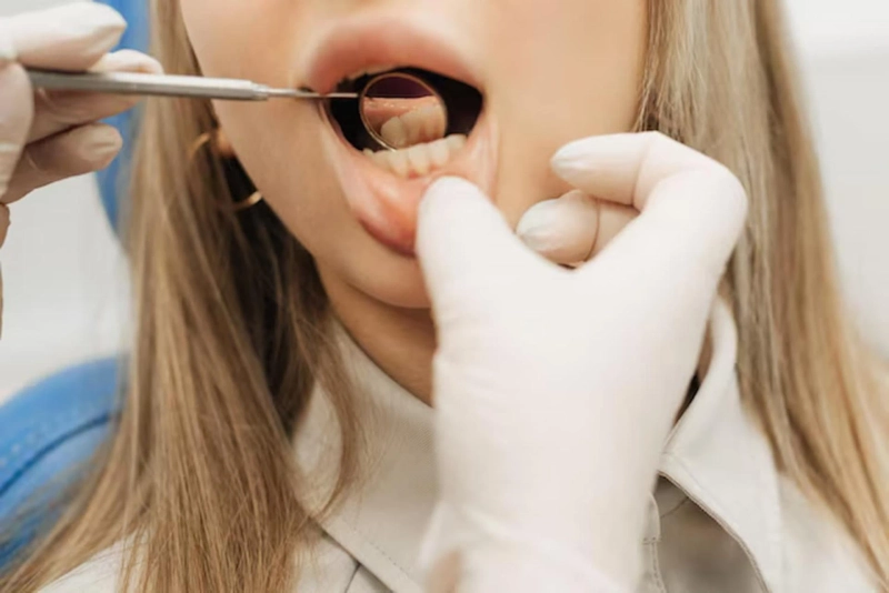 Early Signs of Gum Disease and When to See a Dentist Near You