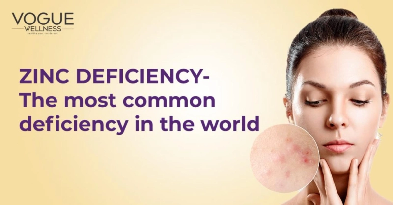 Zinc Deficiency- The Most Common Deficiency in the World