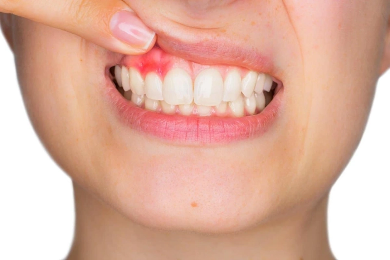 Feeling Pain In Your Gums? Here Are Some Tips To Maintain Healthy Gums