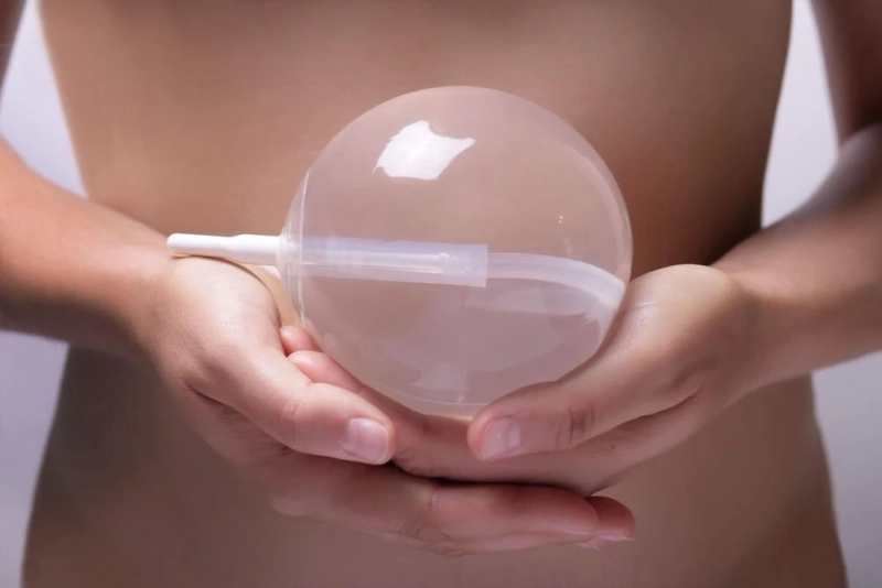 The Ultimate Guide to Gastric Balloon in Riyadh: What You Need to Know