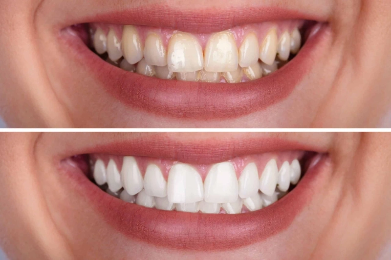 Dental Clinic in Tembhi Naka Thane