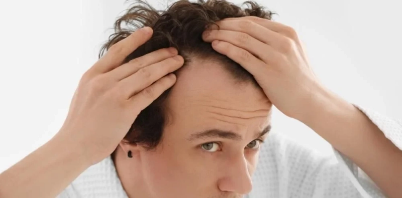 Why a Hair Transplant Might Be Right for You