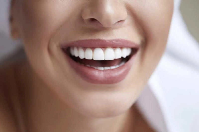 Porcelain Veneers - Are They For You?