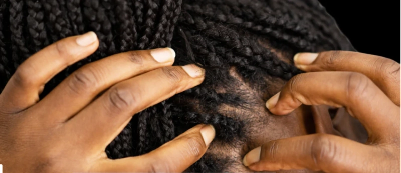 High Porosity Hair Care: Strategies for Strengthening and Moisturizing