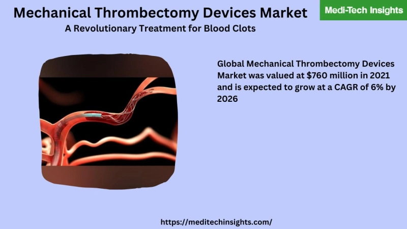 Global Mechanical Thrombectomy Devices Market was valued at US$ 760 million in 2021 and is projected to expand at a CAGR of 6% by 2026