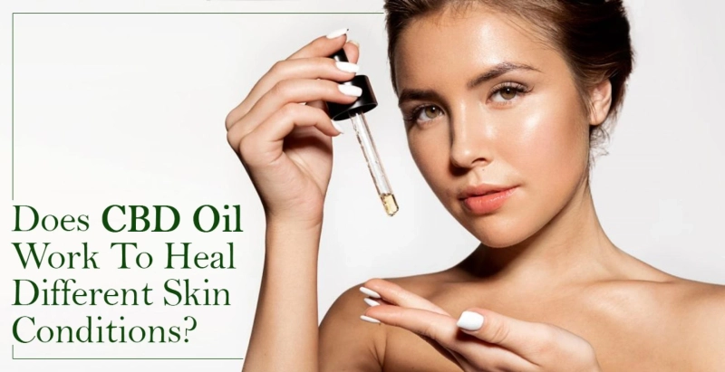 Does CBD Oil Work To Heal Different Skin Conditions?