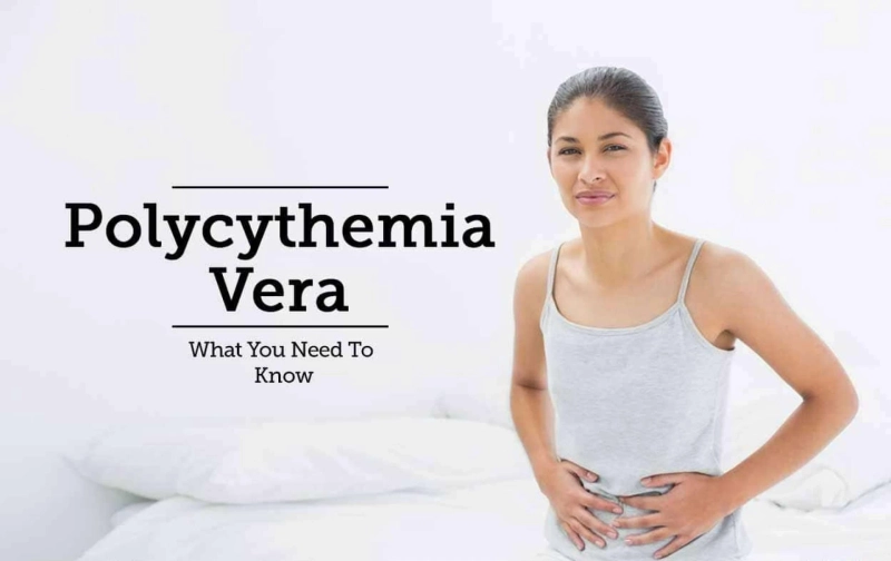 What is Polycythemia Vera? | Specialty Care Clinic