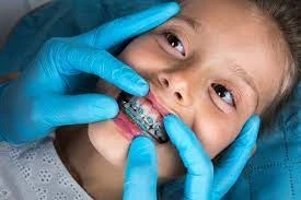 Enhance Your Smile with Innovative Dental Braces