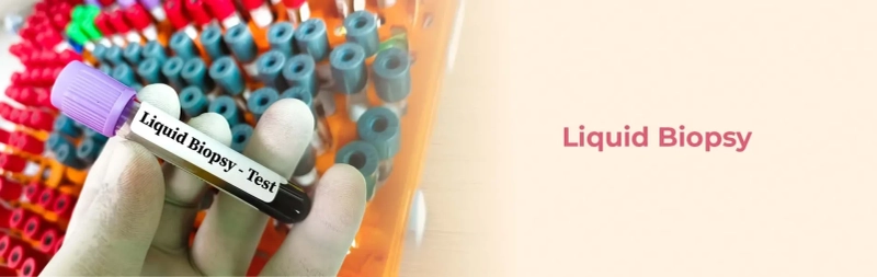 Liquid Biopsy For Cancer Diagnosis: Everything You Need To Know