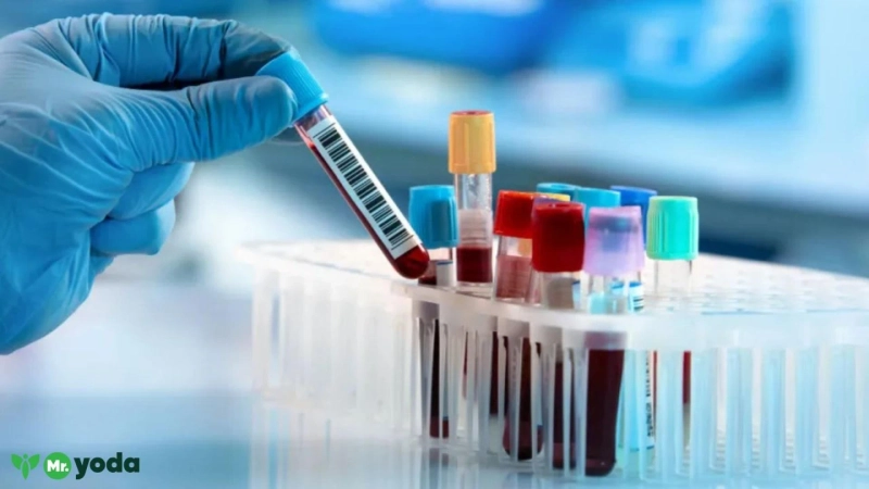 Diagnostics in Hyderabad: A Simple Guide to Modern Testing Services