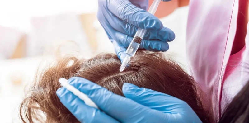 PRP Hair Treatment in Dubai: Gentle Approach