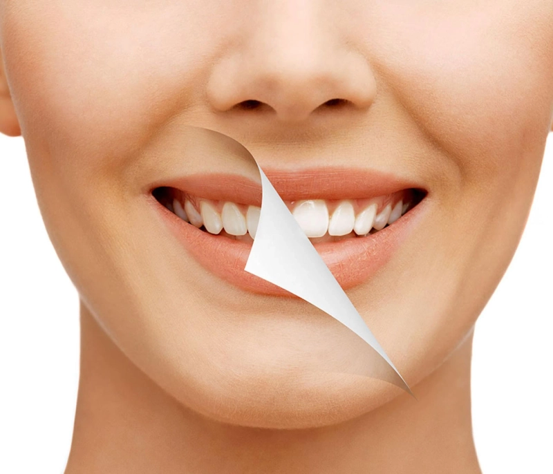 Teeth whitening in Hamilton: achieve a brighter, more confident smile