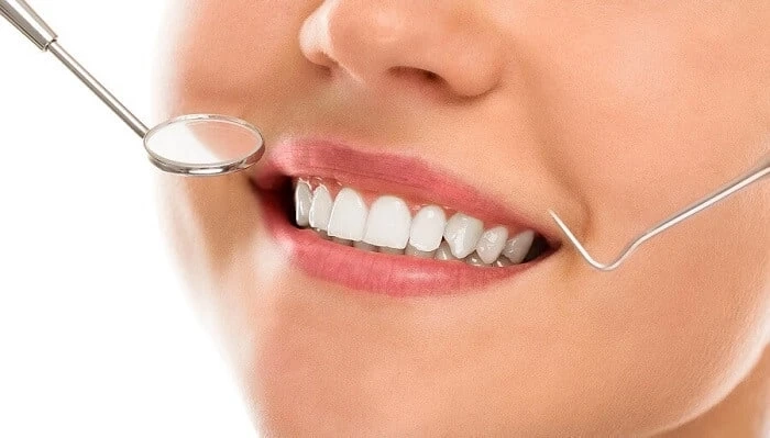 Cosmetic Bonding vs. Dental Veneers. Which One to Choose?