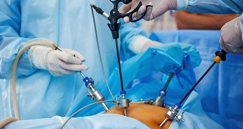 How a Laparoscopic Surgeon Can Help with Gallbladder and Hernia Issues