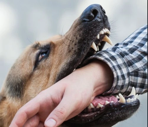 Dog Bites and Animal Attacks: When You Need an Accident Attorney