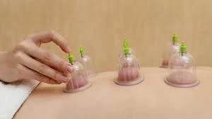 Hijama and Pain Management: Efficacy and Benefits