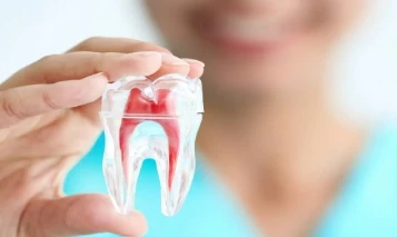 Frequently Asked Questions About Dental Implants