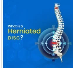 Bulging Disc Vs. Herniated Disc: What's The Difference?