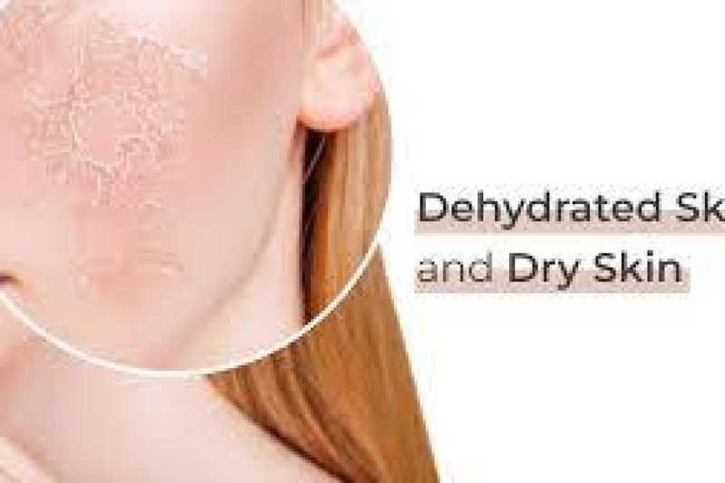 Dry Or Dehydrated Skin? What’s The Difference?