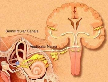 What is Vestibular Paroxysmia treatment
