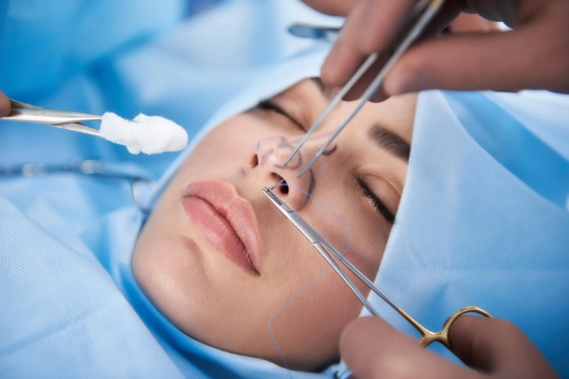 Reshape with Confidence: Rhinoplasty in Riyadh