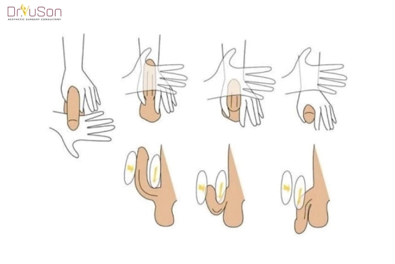 Cách tăng kích thước cậu nhỏ bằng tay chia sẻ thật trên cộng đồng báo nước ngoài