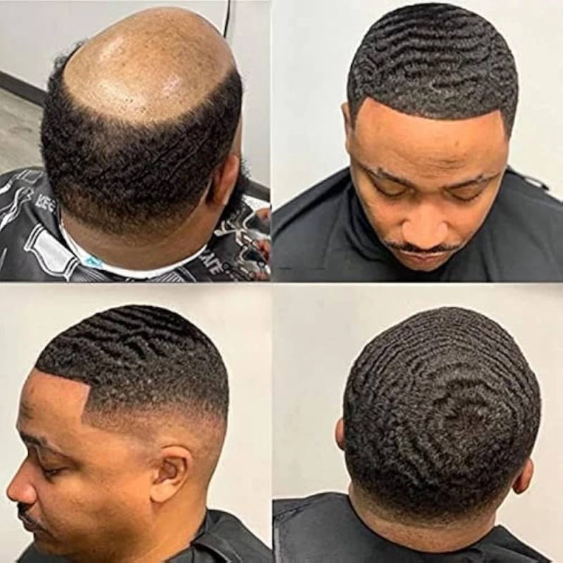 Mens Hair Systems - good about your appearance strengthens 