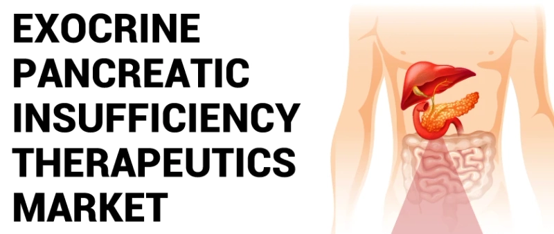 Global Exocrine Pancreatic Insufficiency Therapeutics Market to Experience a Positive Growth Trajectory with Exciting Advancements in EPI Treatment Techniques.