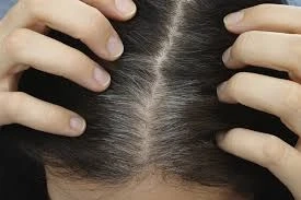What are the risks of white hair removal treatments in Dubai?