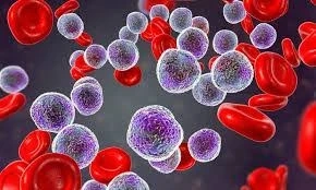 A cancer that grows rapidly and usually worsens rapidly is leukemia