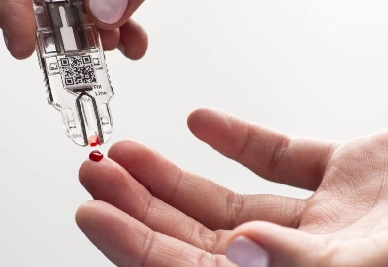 Point Of Care Diagnostics Market Rising Demand and Growth Analysis, Forecast up to 2025