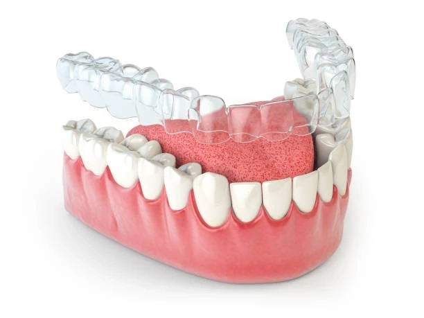 How Invisalign Corrects Overbites, Gaps, and Crowded Teeth