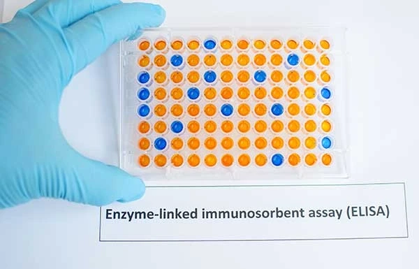 Scope of Global ELISA Tests  Market Size, Status and Top Key Vendors Forecast to 2028