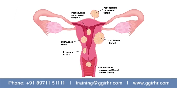 Online IUI  workshop - from GGIRHR! Hurry up, Limited Seats Available!