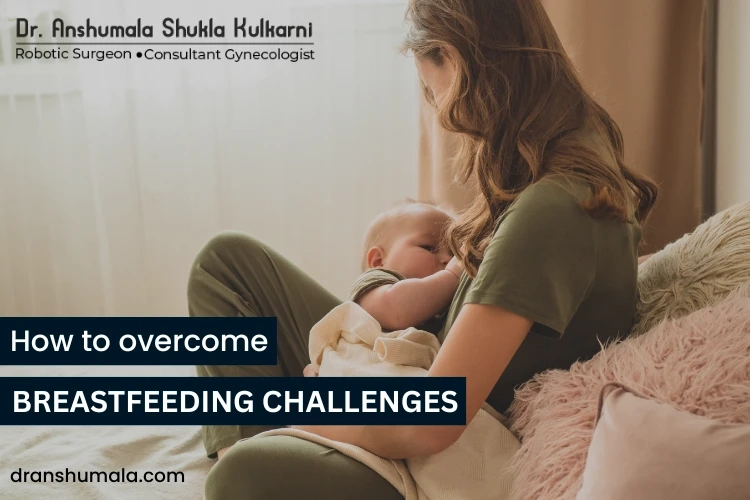 How to overcome Breastfeeding Challenges