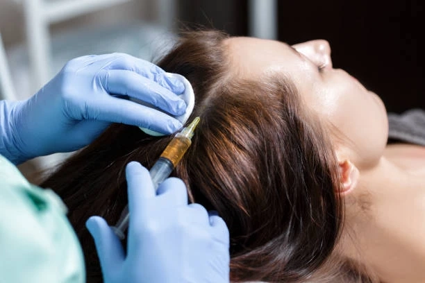 Benefits of platelet-rich plasma (PRP) therapy and how it works