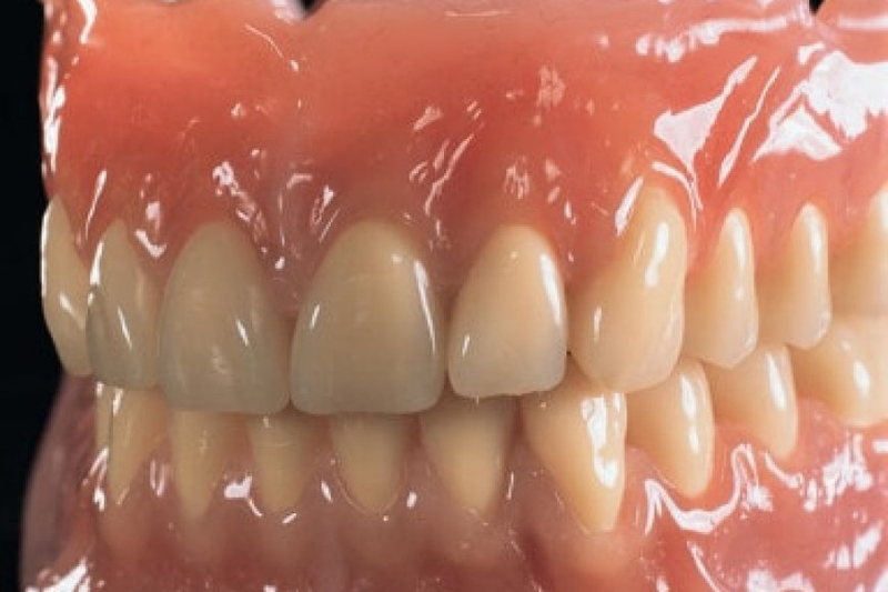 Why Complete Dentures Are Good?