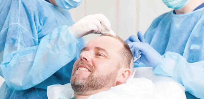 Mirror, Mirror: Reflecting on the Miraculous Effects of Hair Transplants