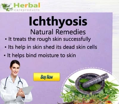 Herbal Treatment for Ichthyosis