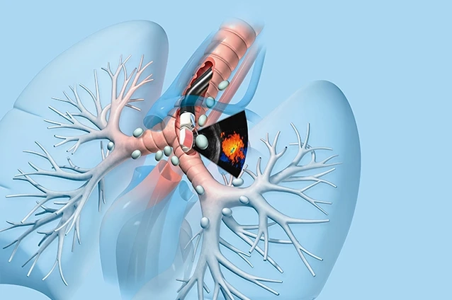Market Insights: Endoscopy Video Processor Industry Overview