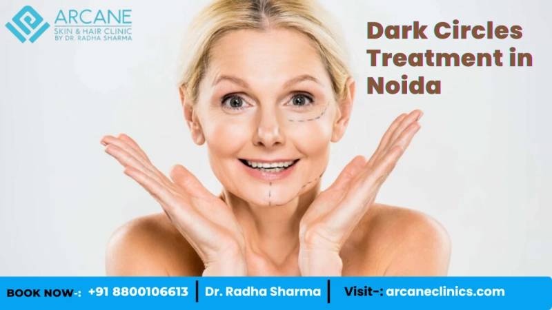 Draft: My Post Best Dark Circle Removal Methods Recommended by DermatologistsTitle