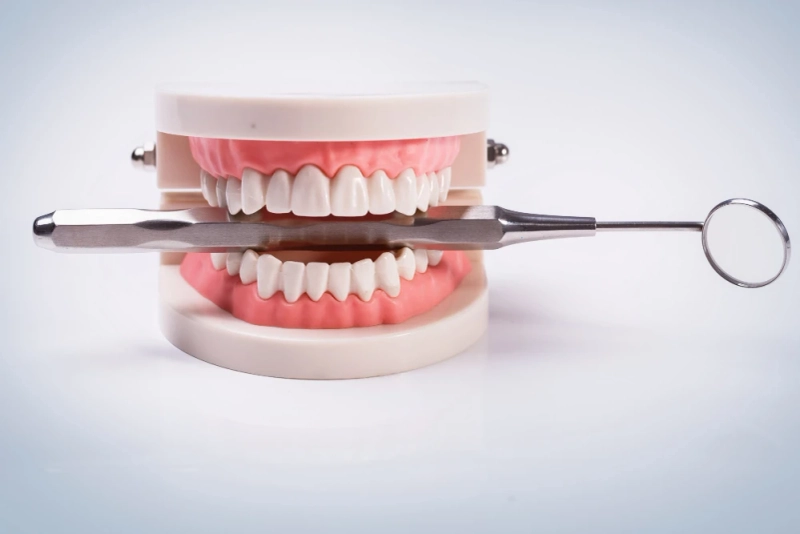 The Advantages of Denture Implants: A Long-Term Solution for Missing Teeth