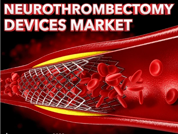 Neurothrombectomy Devices Market Growth Trajectories & Trends Across Industries 2032
