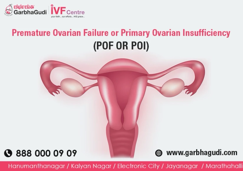 Premature Ovarian Failure or Primary Ovarian Insufficiency (POF OR POI