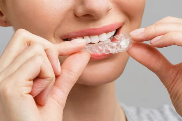 Benefits of Choosing Clear Aligners for a Confident Smile