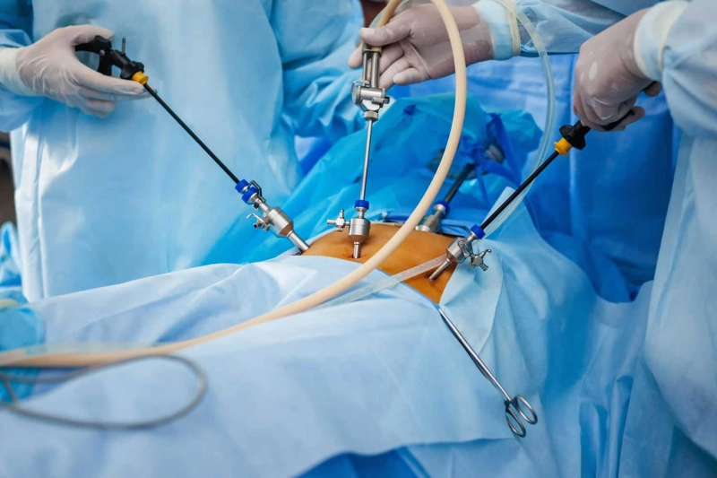Common Conditions Treated with Laparoscopic Surgery