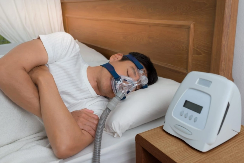 Sleep Apnea Devices Market Size and Growth Forecast : Top Manufacturers,Future Developments,Regional Analysis.