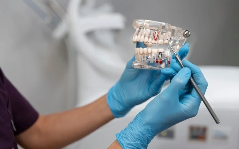 Tips For Evaluating The Lifespan Of Your Dental Bridges