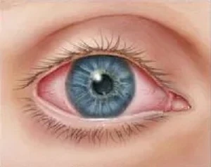 Importance of Annual Visit to an Eye Doctor Aventura