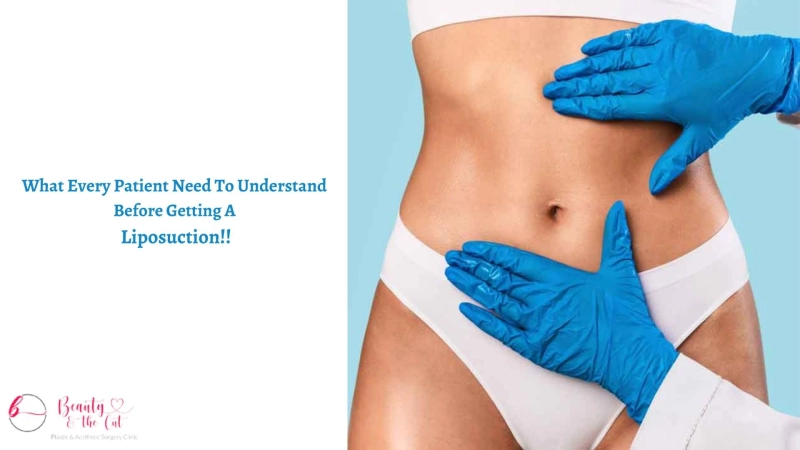 What Every Patient Need To Understand Before Getting A Liposuction